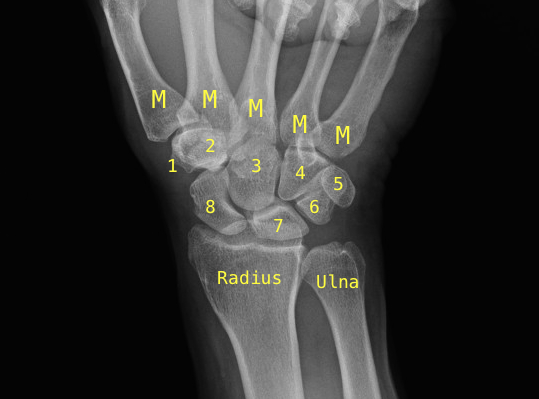 Radiology studies - X-ray | Hand Surgery Source